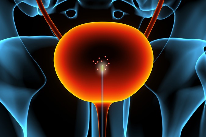 MIT-Bladder-Cancer-01-press.jpg