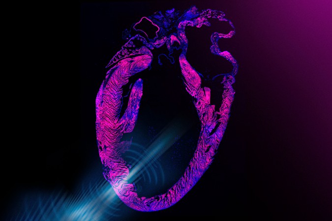 MIT-UltraSoundPacemaker-01-press.jpg