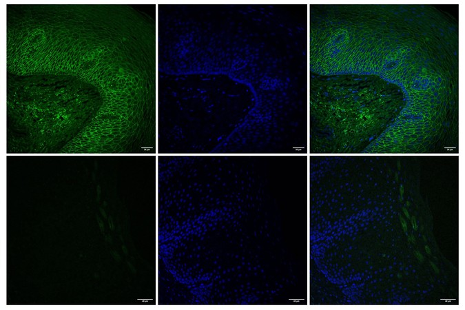 Engineers find a way to deliver drugs directly to the esophagus