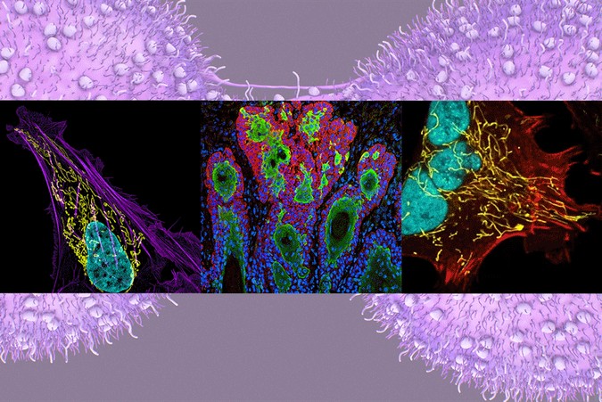 MIT-Cancer-Models-01.gif