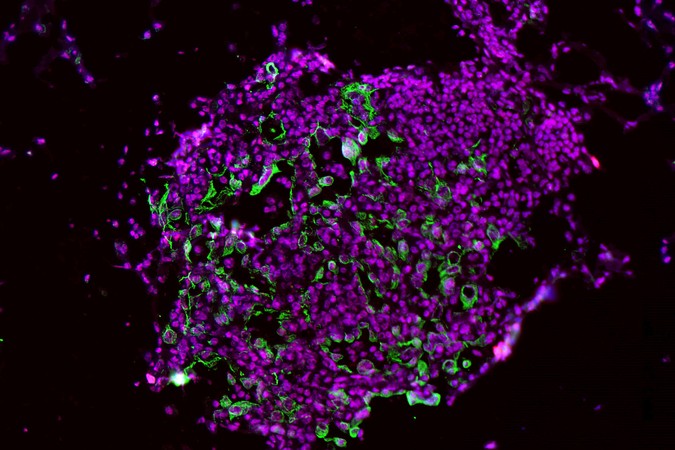 MIT_Lung-Cancer-Prevention-01-press.jpg